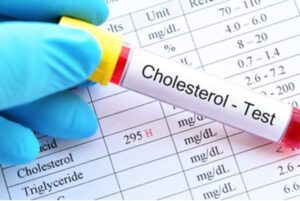 Cholesterol Test Tube